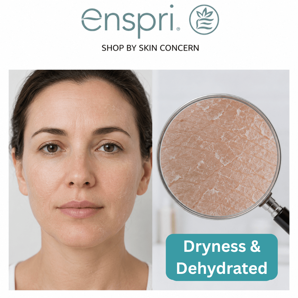 An Enspri brand graphic titled "SHOP BY SKIN CONCERN." On the left, a close-up photo shows a woman's face with visible flaking and fine lines on her forehead and cheeks. On the right, a magnifying glass focuses on a highly magnified view of extremely dry, cracked, and peeling skin texture. A teal badge at the bottom reads "Dryness & Dehydrated."