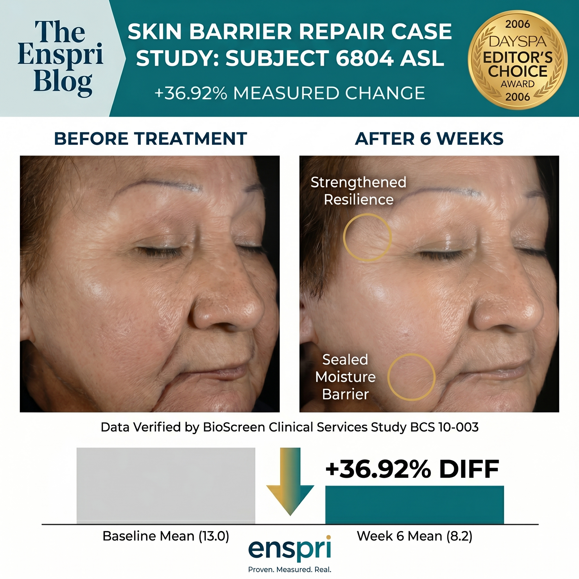 In a 6-week independent clinical study, Enspri Sheer Ceramide demonstrated a significant medical-grade improvement in skin barrier function. Using Transepidermal Water Loss (TEWL) metrics, the formula was proven to reinforce the skin's natural moisture seal, moving compromised skin into a healthy, stabilized range.