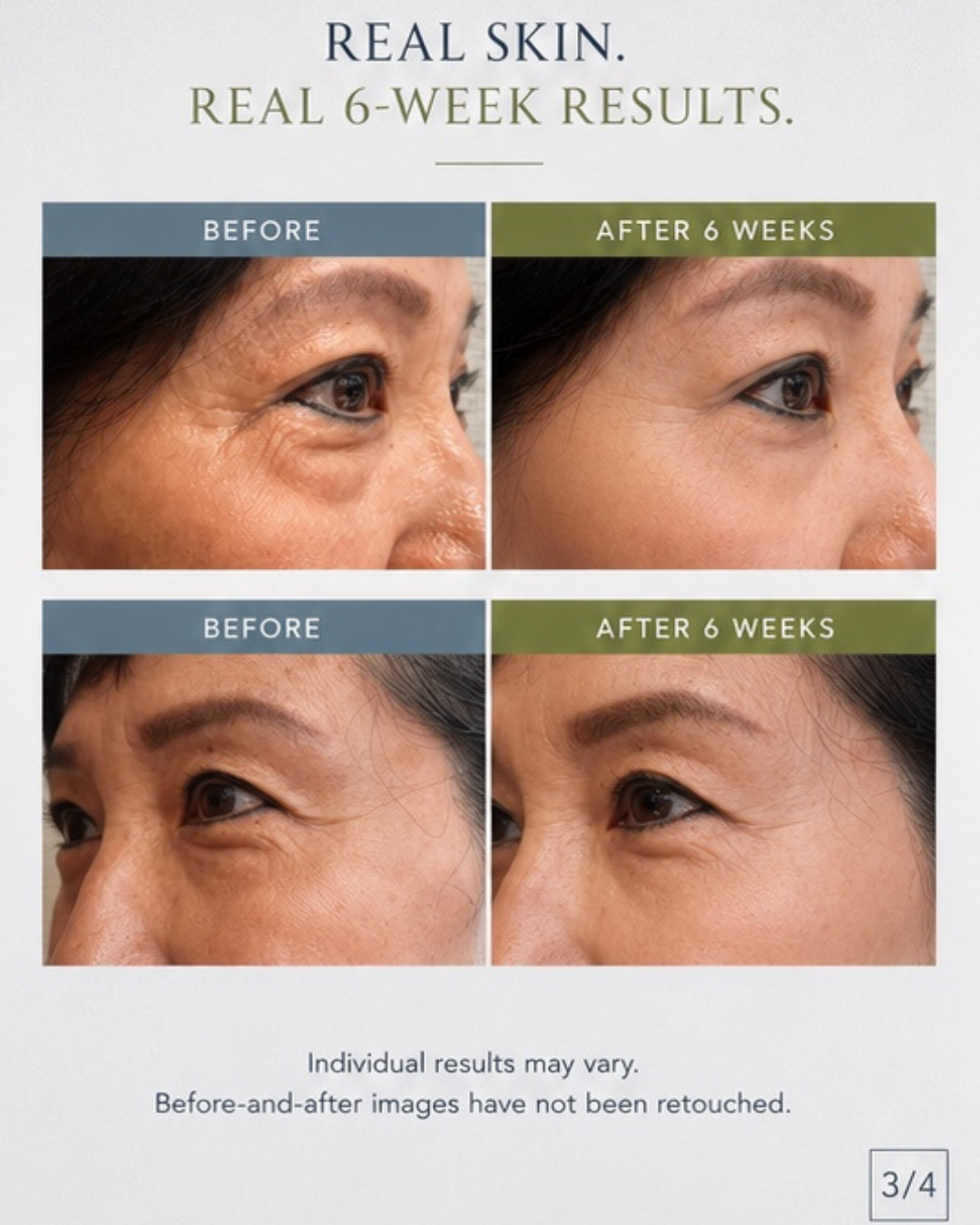 A before-and-after comparison graphic showing four close-up facial skin panels labeled 'Before' and 'After 6 Weeks,' with the headline 'REAL SKIN. REAL 6-WEEK RESULTS.