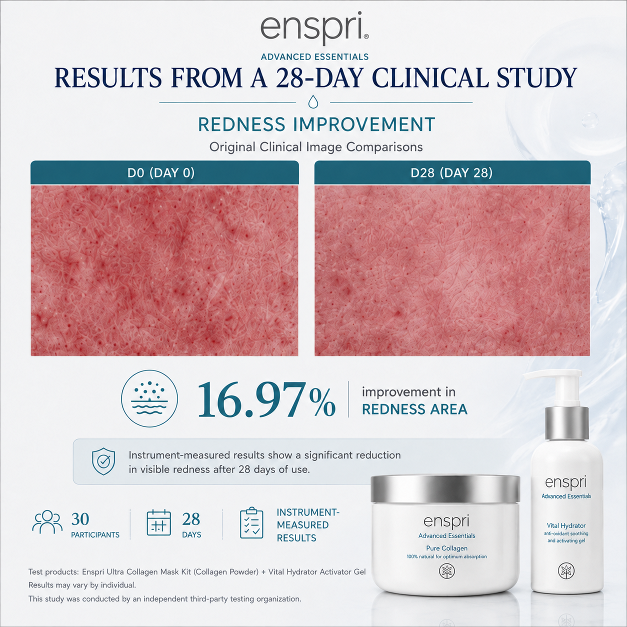 An informational marketing graphic for Enspri Advanced Essentials skincare, featuring before-and-after redness comparison images labeled D0 and D28, a statistic of 16.97% improvement, and product packaging including a collagen mask kit jar and a hydrator gel bottle.